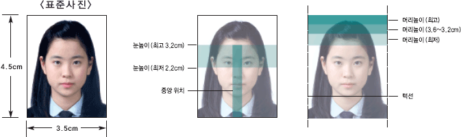 머리손상
